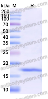 Recombinant Mouse FGF6 Protein, N-His