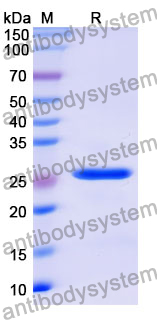 Recombinant Mouse MBL2/MBP-C Protein, N-His-SUMO