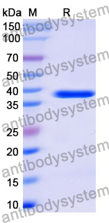 Recombinant Mouse CD79α/CD79A Protein, N-GST & C-His