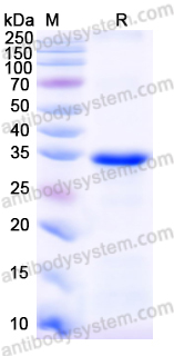 Recombinant Mouse CD64/FCGR1A Protein, N-His