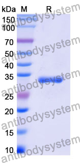 Recombinant Mouse CD143/ACE Protein, N-His