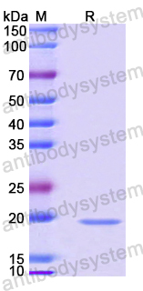 Recombinant Mouse CCL4/MIP-1-beta Protein, N-His-SUMO