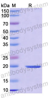 Recombinant Mouse CCL5/RANTES Protein, N-His-SUMO