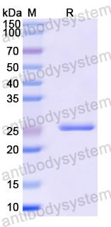 Recombinant Mouse CD142/F3/TF Protein, N-His