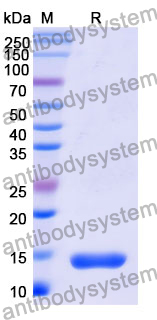 Recombinant Mouse GFAP Protein, N-His