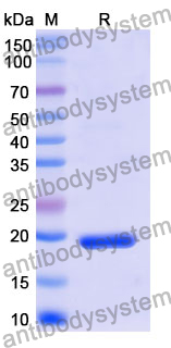 Recombinant Mouse FOLR1 Protein, N-His