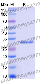 Recombinant Mouse CD116/CSF2RA Protein, N-His