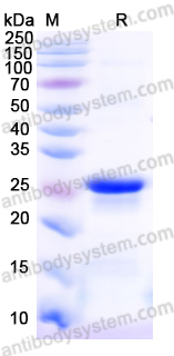 Recombinant Mouse CD31/PECAM1 Protein, N-His