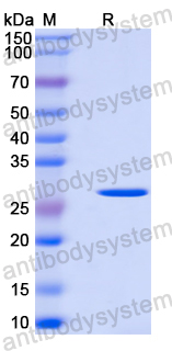 Recombinant Mouse CRISP2 Protein, N-His