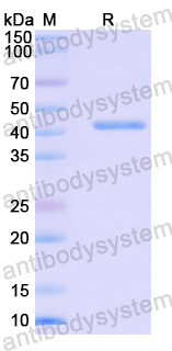 Recombinant Mouse CD36 Protein, N-His