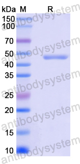 Recombinant Mouse IFNAR1 Protein, N-His
