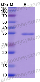 Recombinant Mouse CD105/ENG Protein, N-His