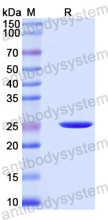Recombinant Mouse EPOR Protein, N-His