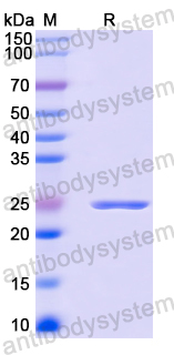 Recombinant Mouse CD106/VCAM1 Protein, N-His