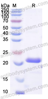 Recombinant Mouse ORM2 Protein, N-His