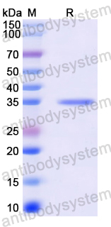 Recombinant Mouse CXCL3/GRO-gamma/MIP2-beta Protein, N-GST & C-His