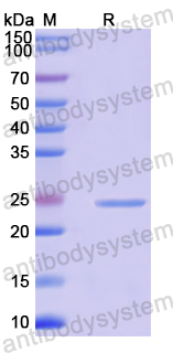 Recombinant Mouse CD22 Protein, N-His