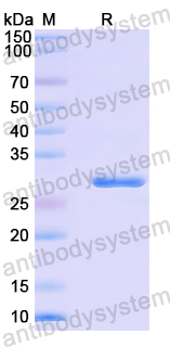 Recombinant Mouse CD120b/TNFRSF1B/TNFR2 Protein, N-His-SUMO