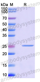Recombinant Mouse OGN Protein, N-His
