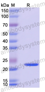 Recombinant Mouse EFNA1 Protein, N-His