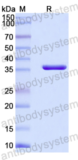 Recombinant Mouse BGN Protein, N-His