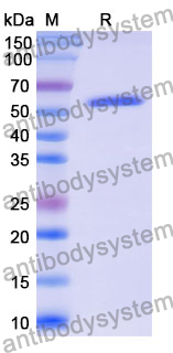 Recombinant Mouse ACHE Protein, N-His