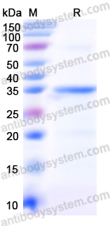 Recombinant Mouse IGFBP4 Protein, N-His
