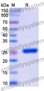 Recombinant Mouse CD124/IL4R/IL-4Rα Protein, N-His