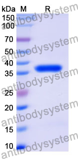Recombinant Mouse IGFBP6 Protein, N-GST & C-His