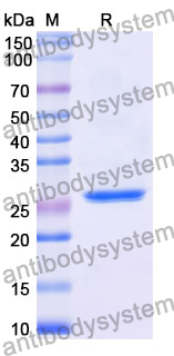 Recombinant Mouse CD95/FAS Protein, N-His-SUMO