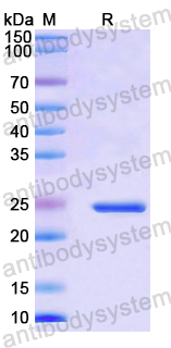 Recombinant Mouse PTX3 Protein, N-His