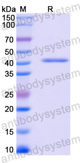 Recombinant Mouse CD159a/KLRC1 Protein, N-GST & C-His