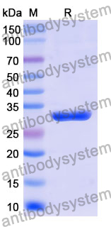 Recombinant Mouse CD123/IL3RA Protein, N-His