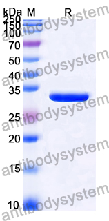 Recombinant Mouse LOX Protein, N-His