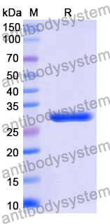 Recombinant Mouse EPHA2 Protein, N-His