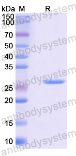 Recombinant Mouse LRPAP1 Protein, N-His