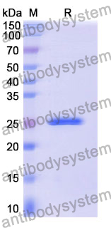 Recombinant Mouse PRSS3 Protein, N-His
