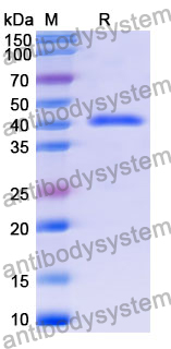 Recombinant Mouse SFTPD Protein, N-GST & C-His