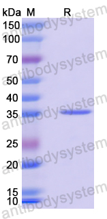 Recombinant Mouse FLT4 Protein, N-His