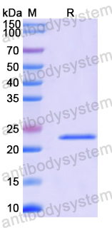 Recombinant Mouse CD135/FLT3 Protein, N-His