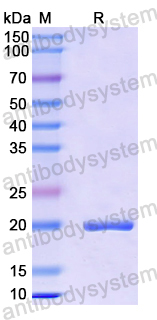 Recombinant Mouse ACVRL1 Protein, N-His-SUMO