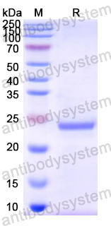 Recombinant Mouse ACVRL1 Protein, N-His-SUMO & C-His