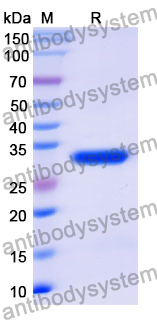 Recombinant Mouse IFNGR2 Protein, N-GST & C-His