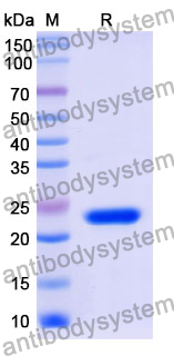 Recombinant Mouse MMP12 Protein, N-His