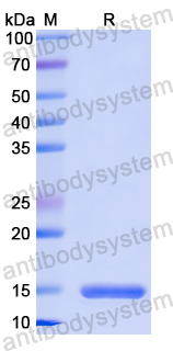 Recombinant Mouse IL5 Protein, N-His