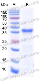 Recombinant Mouse WNT5A Protein, N-His