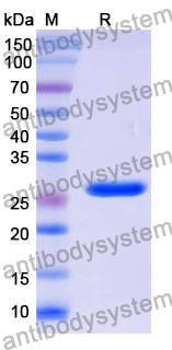 Recombinant Mouse CD86/B7-2 Protein, N-His