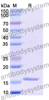 Recombinant Mouse CXCL5/ENA-78 Protein, N-His-SUMO