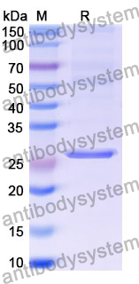 Recombinant Mouse CD146/MCAM Protein, N-His