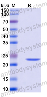 Recombinant Mouse DCC Protein, N-His